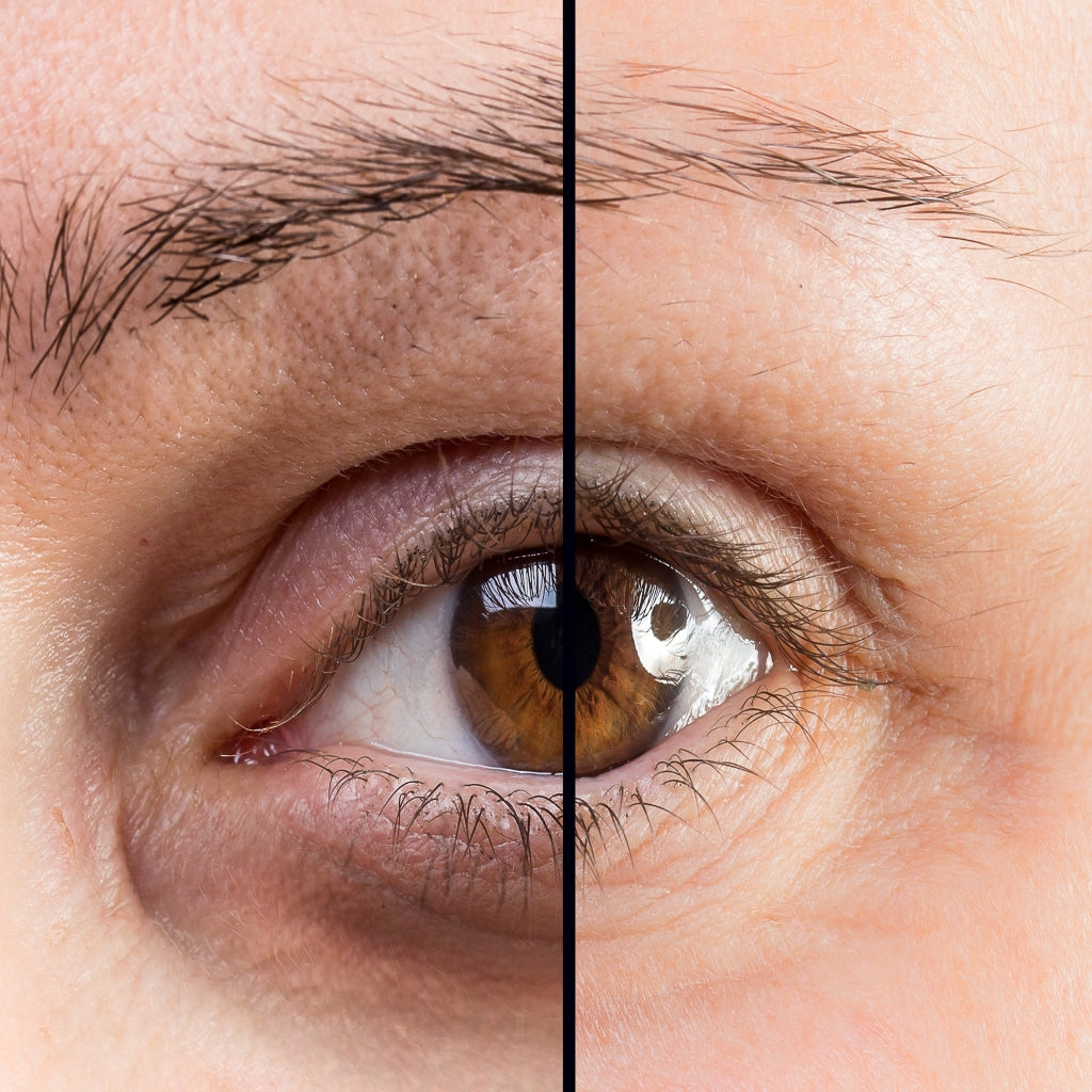 close up of woman's eye showing before and after using Revive Under Eye Cream