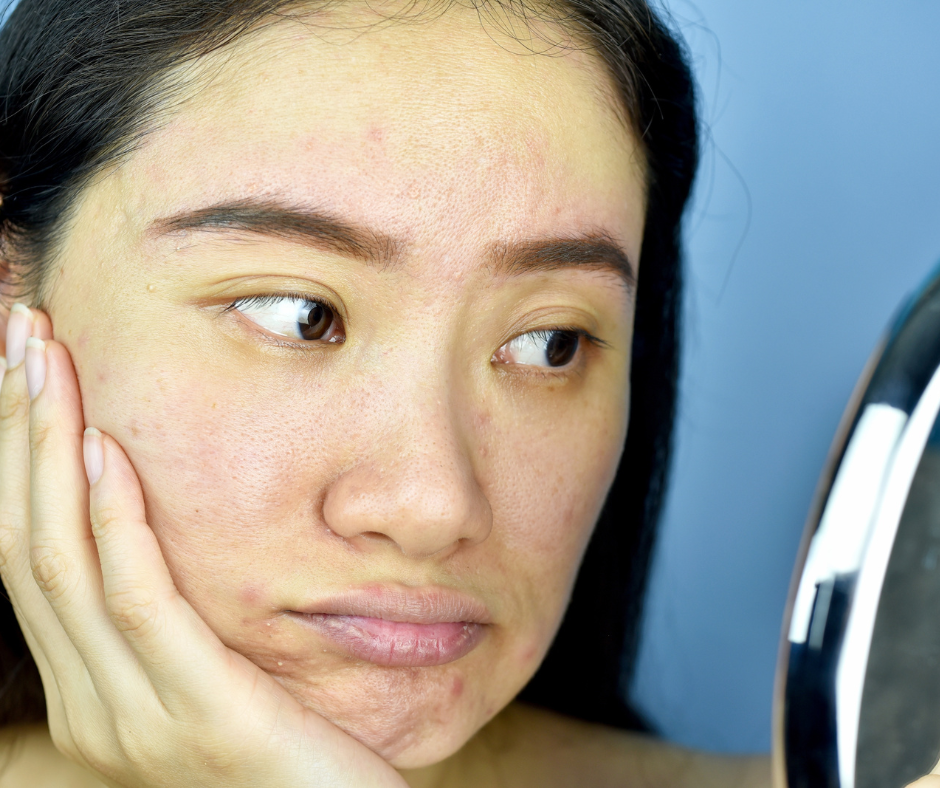 Is Your Skincare Routine Wrecking Your Skin Barrier?